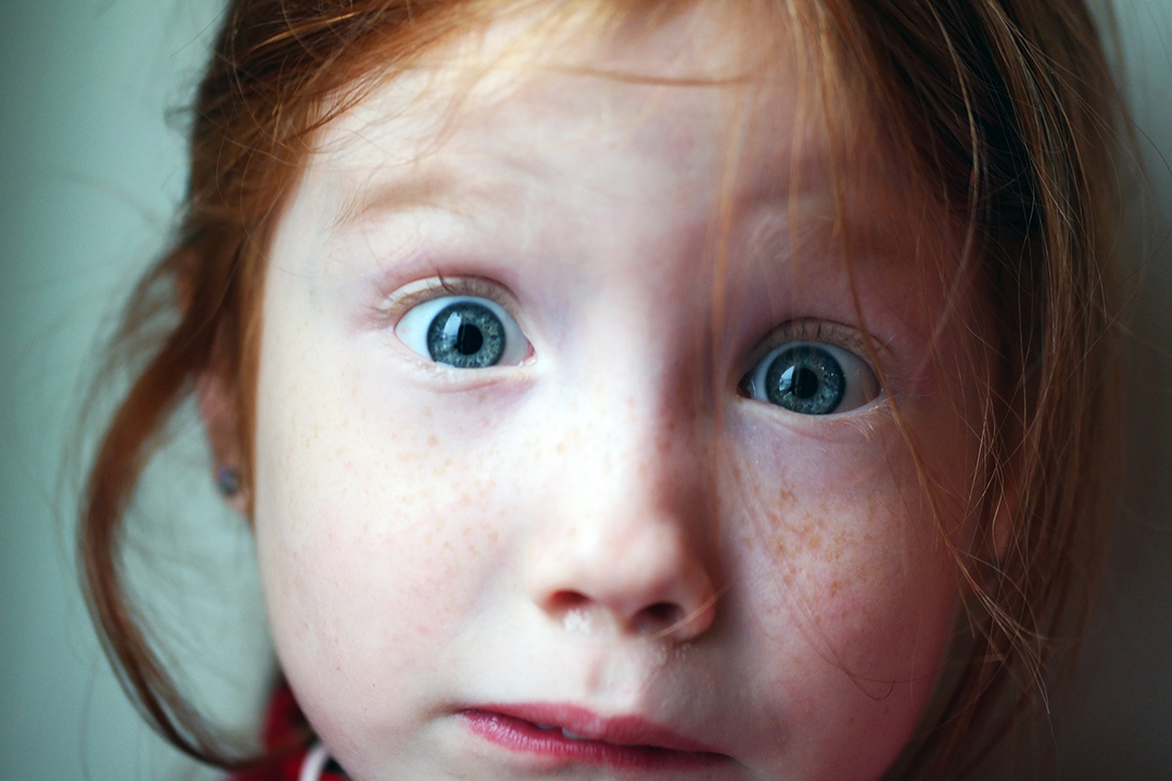 Tratamiento logopédico dislalia fonema "r".